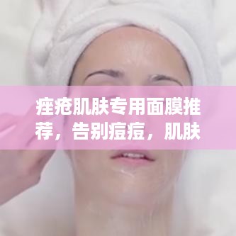 痤疮肌肤专用面膜推荐，告别痘痘，肌肤焕发光彩！