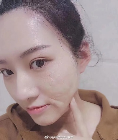 瘦脸啫喱面膜大揭秘，这些品牌让你轻松拥有小脸美