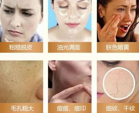 欧洲护肤界的明星—涂抹式清洁面膜推荐