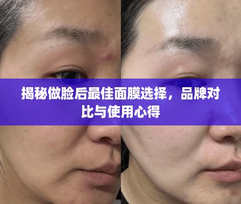 揭秘做脸后最佳面膜选择，品牌对比与使用心得