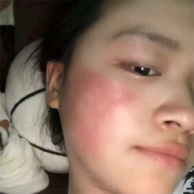 过敏肌肤专用面膜大推荐，告别红肿不适，肌肤焕然一新！