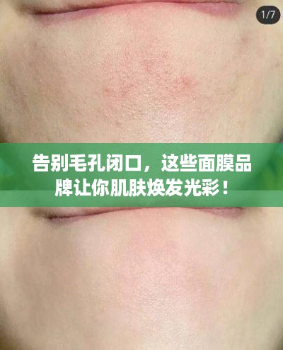 告别毛孔闭口，这些面膜品牌让你肌肤焕发光彩！