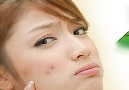 告别痘痘困扰，这些去痘面膜大品牌值得信赖！