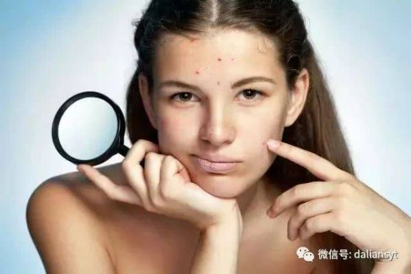 告别痘痘困扰，这些面膜品牌助你美丽瘦身！