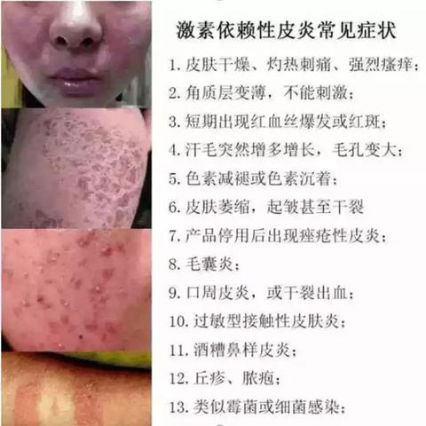 销售无品牌面膜的法律风险与注意事项