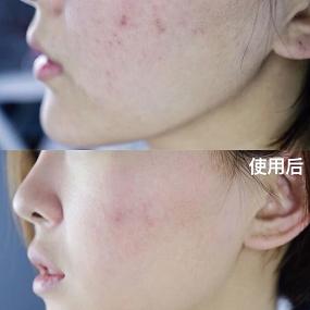 盘点十大抗衰面膜品牌，让你的肌肤重返年轻态！