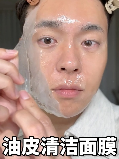 男士去油腻面膜推荐，清爽肌肤，告别油光满面