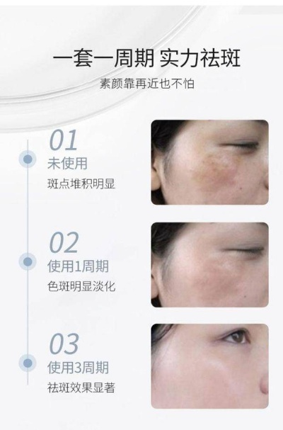 江门祛斑面膜品牌加盟攻略，如何选择热门品牌，开启美丽事业