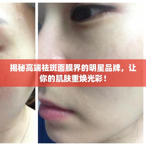 揭秘高端祛斑面膜界的明星品牌，让你的肌肤重焕光彩！
