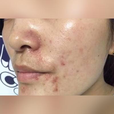 精华油敷面膜，肌肤水润透亮的秘密武器！