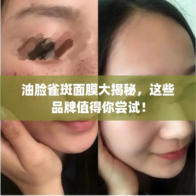 油脸雀斑面膜大揭秘，这些品牌值得你尝试！
