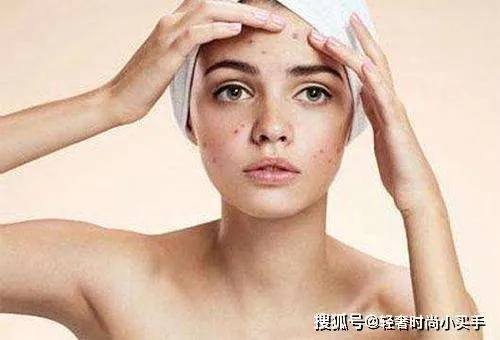 告别痘痘困扰，这些面膜品牌帮你战痘到底！