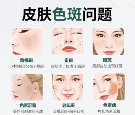 告别斑点困扰，这些面膜品牌让你焕发无瑕美肌！