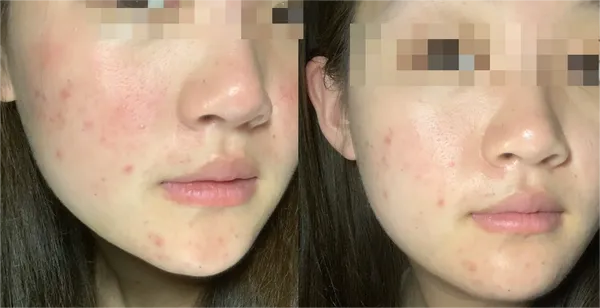 女生必看!2023年口碑面膜红黑榜+选购指南(附成分表+真人实测) 女生必看!2023年口碑面膜红黑榜+选购指南(附成分表+真人实测)